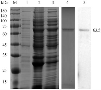 Development of an Indirect ELISA to Detect African Swine Fever Virus pp62 Protein-Specific Antibodies